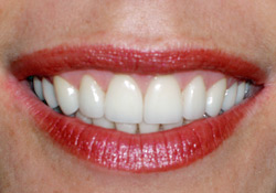 Cosmetic Dentist Smile Repair