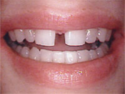Before image