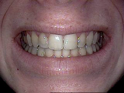 After image