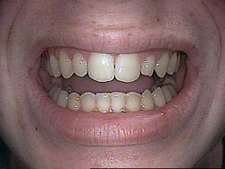 Before image