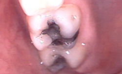 Before image