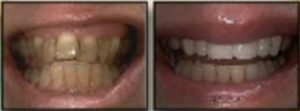 cosmetic dentistry in cleveland