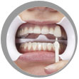 After Zoom Whitening